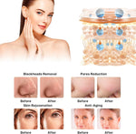 Load image into Gallery viewer, 14 In 1 Hydro Facial Machine Skin Peeling Hydra Beauty Facial Hydradermabrasion Korea Aqua Peel Machine